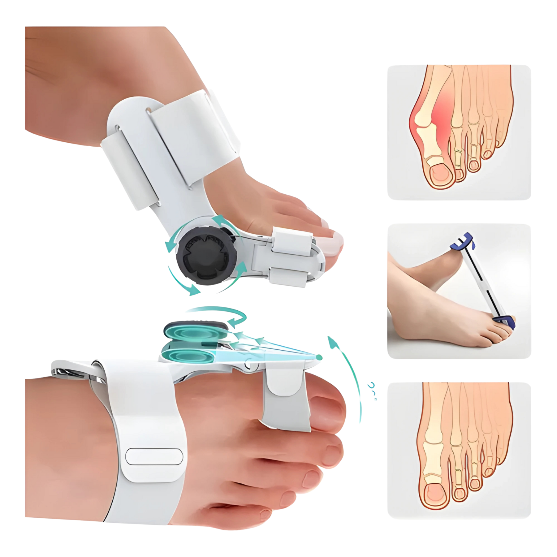 Corrector de Juanetes Ajustable | Férula Ortopédica para Dedo Gordo del Pie