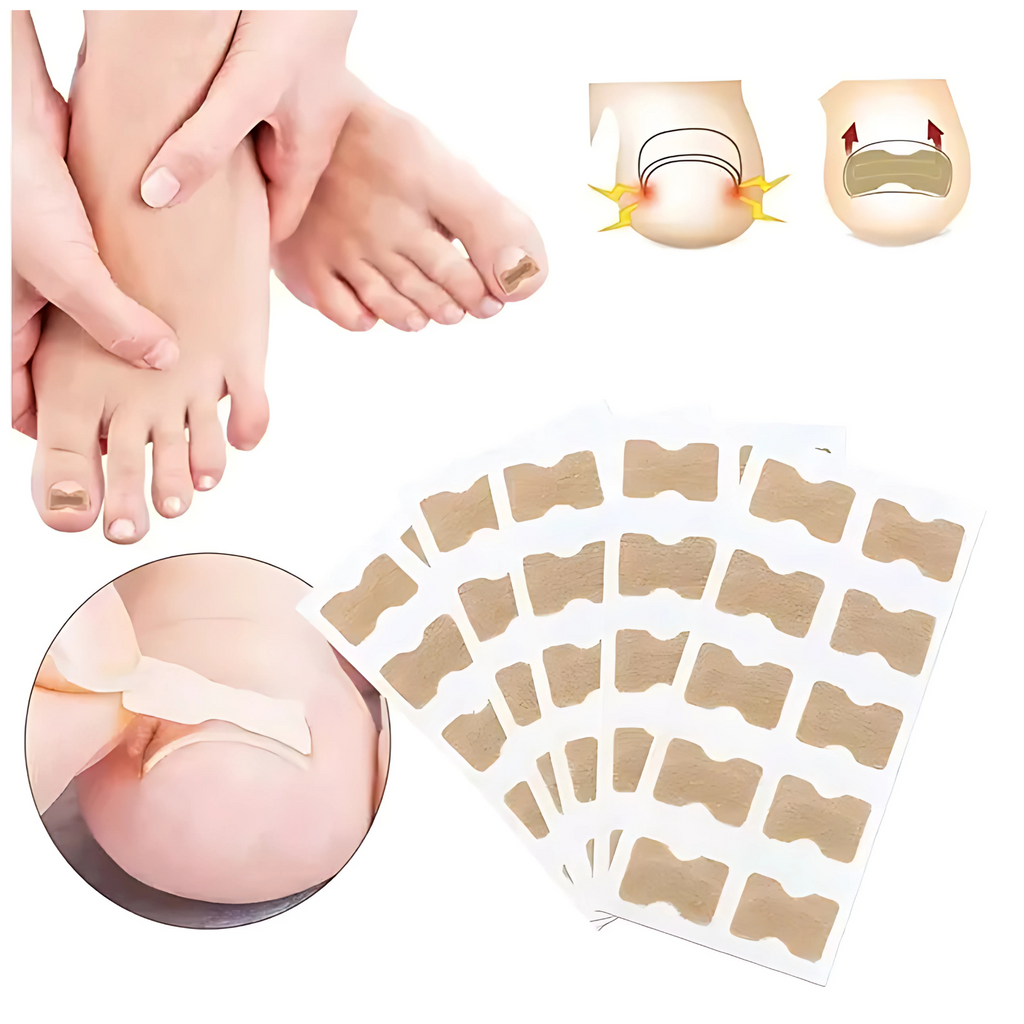 50 Parches Para Uñas Encarnadas Corrector Protector Tratamiento Rápido Seguro Efectivo